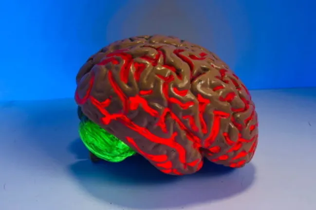 A brain in colour. Image by natasha connell