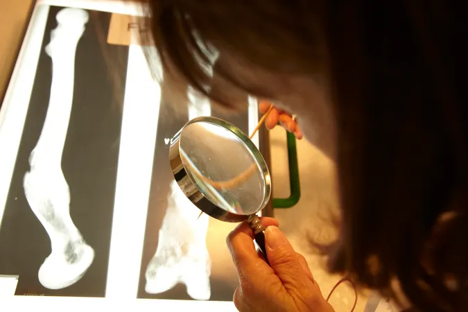 Someone inspecting a bone with a magnifying glass
