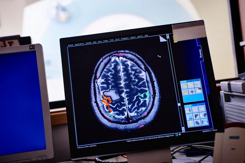 A computer monitor displaying brain data in fMRI control room.