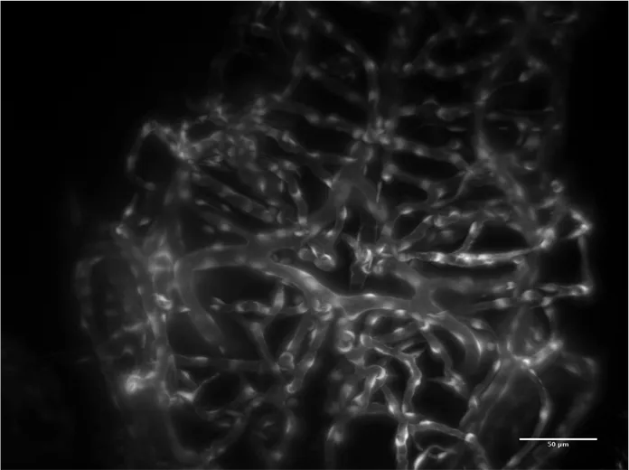 Blood vessels in a developing Zebrafish brain taken with a Single Plane Illumination Microscope (SPIM)